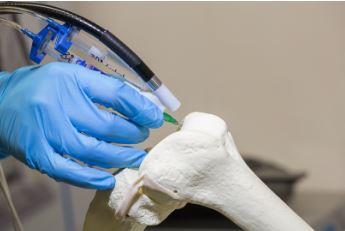 Bristol Araştırmacıları, 3D Baskı Kıkırdak ve Kemik İmplantları İçin Yeni Doku Hücresi Kartuşu Geliştirdiler.