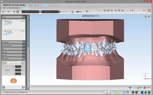 Maestro 3D Ortho Studio